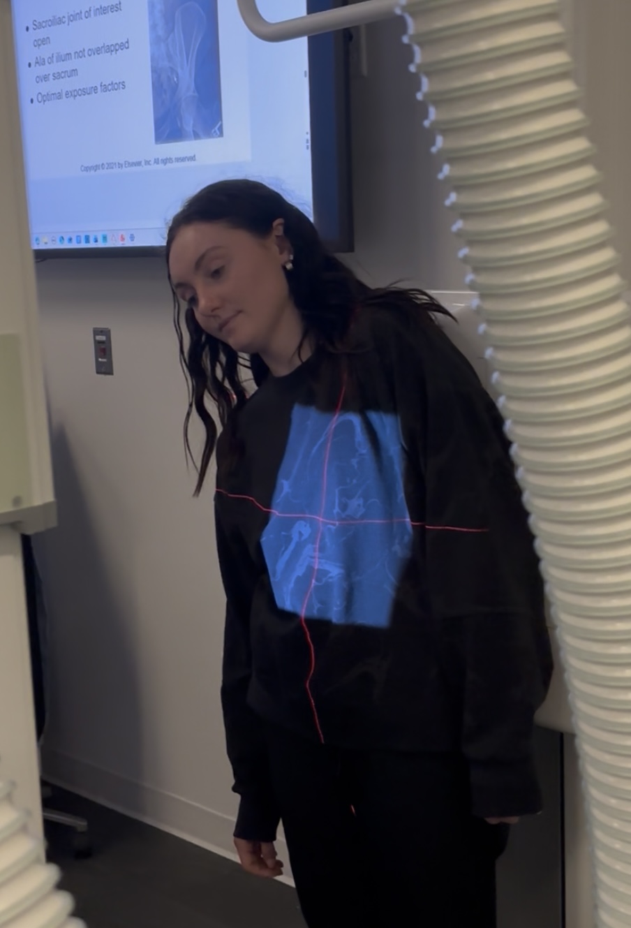 <p>Scoliosis- R&amp;L Bending</p>