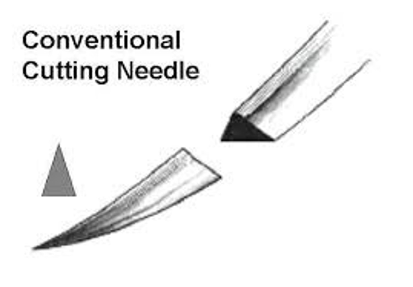 <p>very sharp, cuts rather than dilates, creates weakness allowing suture to tear out; end triangle in shape (three cutting edges)</p>