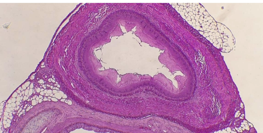 <p>What is the histology?</p>