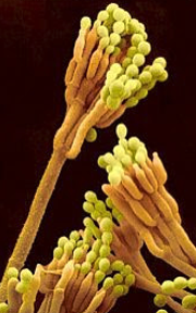 <p>what is this? what genus + fungi type is it?</p>