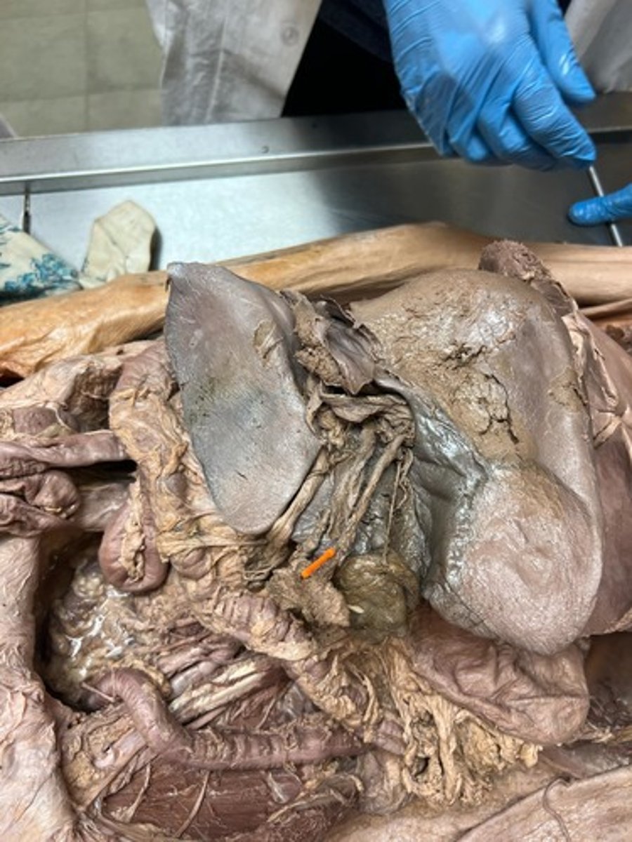 <p>bile duct</p>