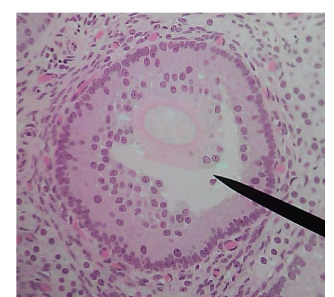 <p>Late secondary follicle </p>