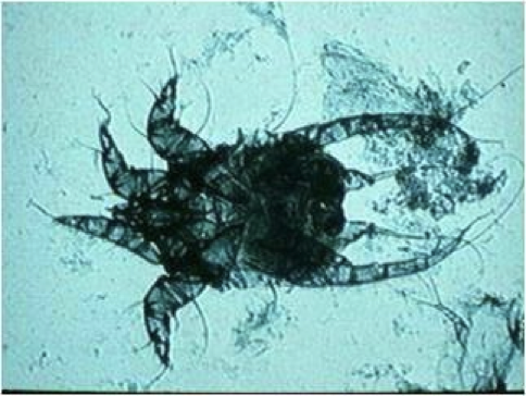 <p>what kind of mite</p>
