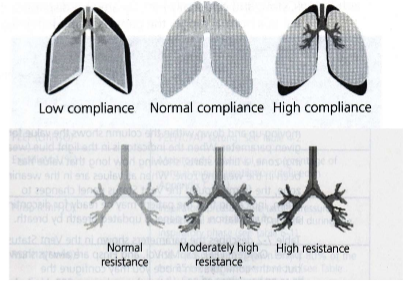 Shows lung C + R with a lung graphic
- low C --> rounder lungs
- high C --> more angular lungs
- low R --> airways less shaded (grey)
- high R --> darker airways (black)

Don't make therapeutic decisions based on this graphic.