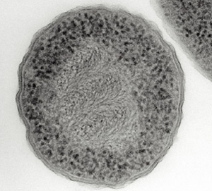 <p>Found in all cells and makes protein and is smaller then a lysosome.</p>