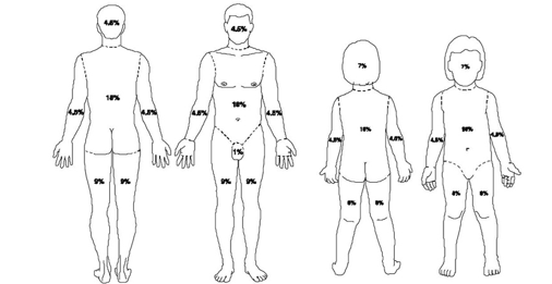 <p>Which population is more at risk for a higher body surface area involvement burn?</p><ul><li><p><u>Adult</u> vs. <u>Children</u></p></li></ul><p></p>