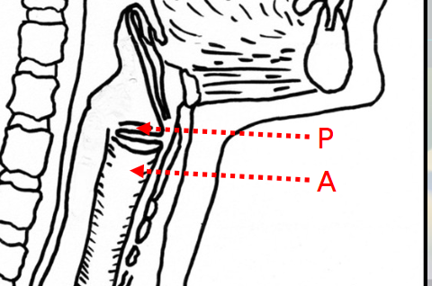 <p>Penetration happens before or at level of vocal folds'</p><p>Aspiration happens lower/ in the larynx </p>