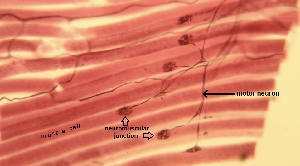 <p>The depicted microscopic slide shows a _______</p>