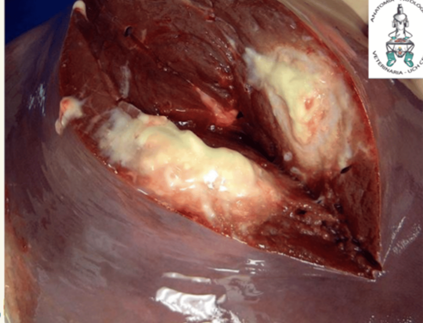 <p>¿diagnóstico morfológico y etiológico?</p>