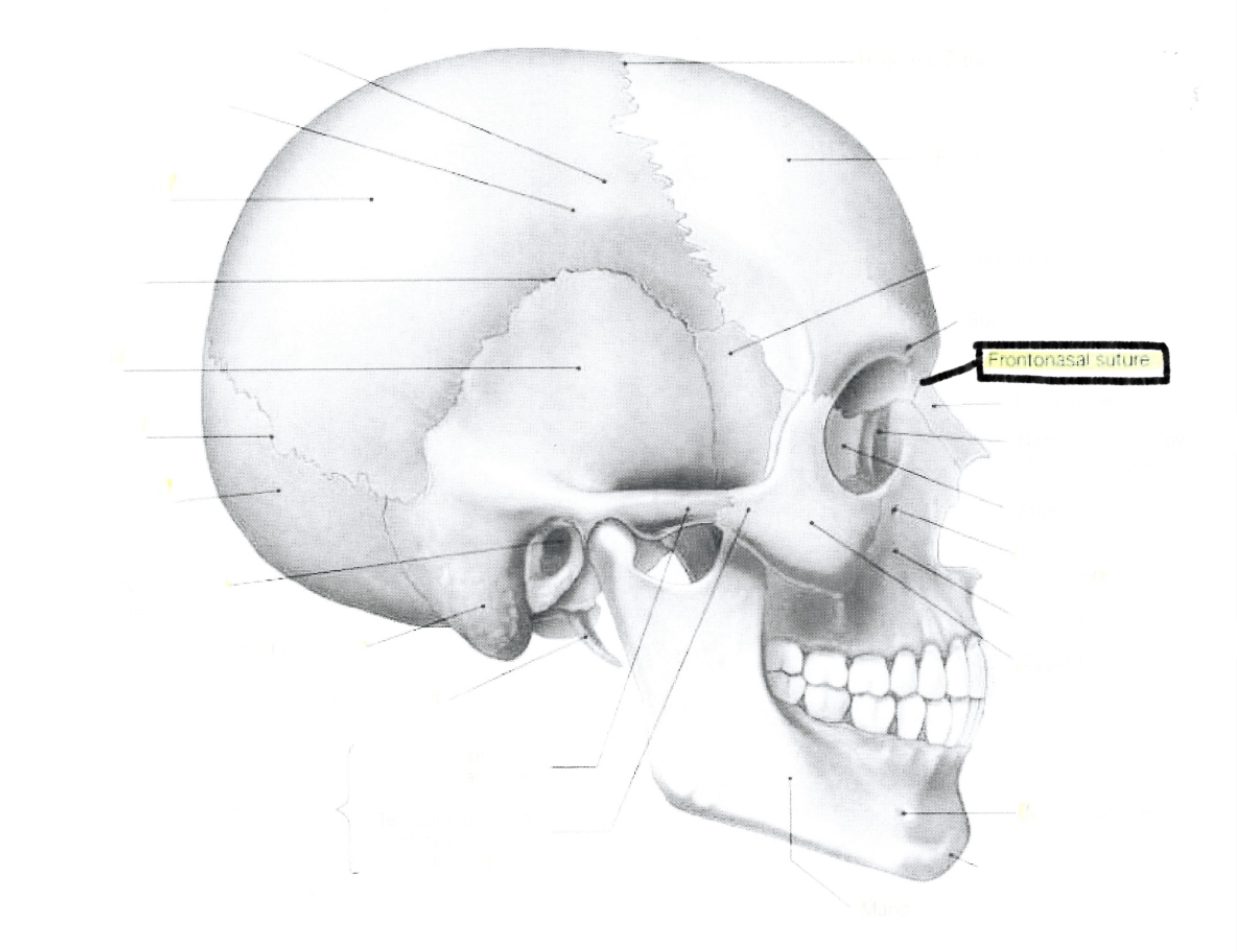 <p>Frontonasal suture</p>