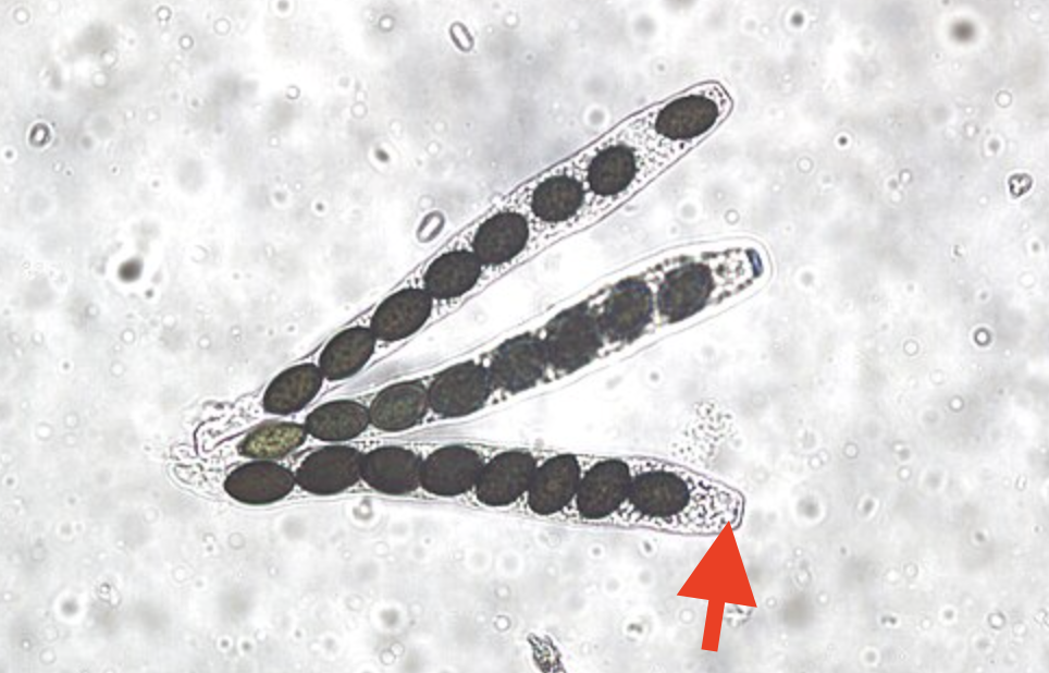 <p>What is the arrow pointing to?</p>