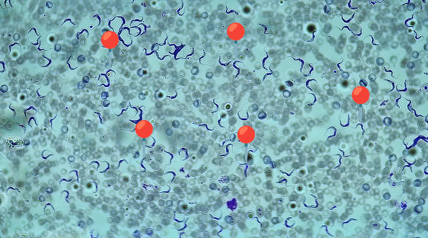 <p><span data-name="worm" data-type="emoji">🪱</span><span data-name="earth_africa" data-type="emoji">🌍</span><span><span> </span></span><strong><em>Trypanosoma gambiense </em></strong><sub>(Trofozoit)</sub></p><p></p><p></p><p><span>🟣</span> - jest większy, bardziej wybarwiony, bardziej liczebny i bardziej powyginany niż <em>Trypanosoma cruzi</em>.</p><p></p><p></p><p><span>😷❓ </span><strong>Parazytoza:</strong><em> Trypanosomoza afrykańska/Śpiączka afrykańska</em></p>