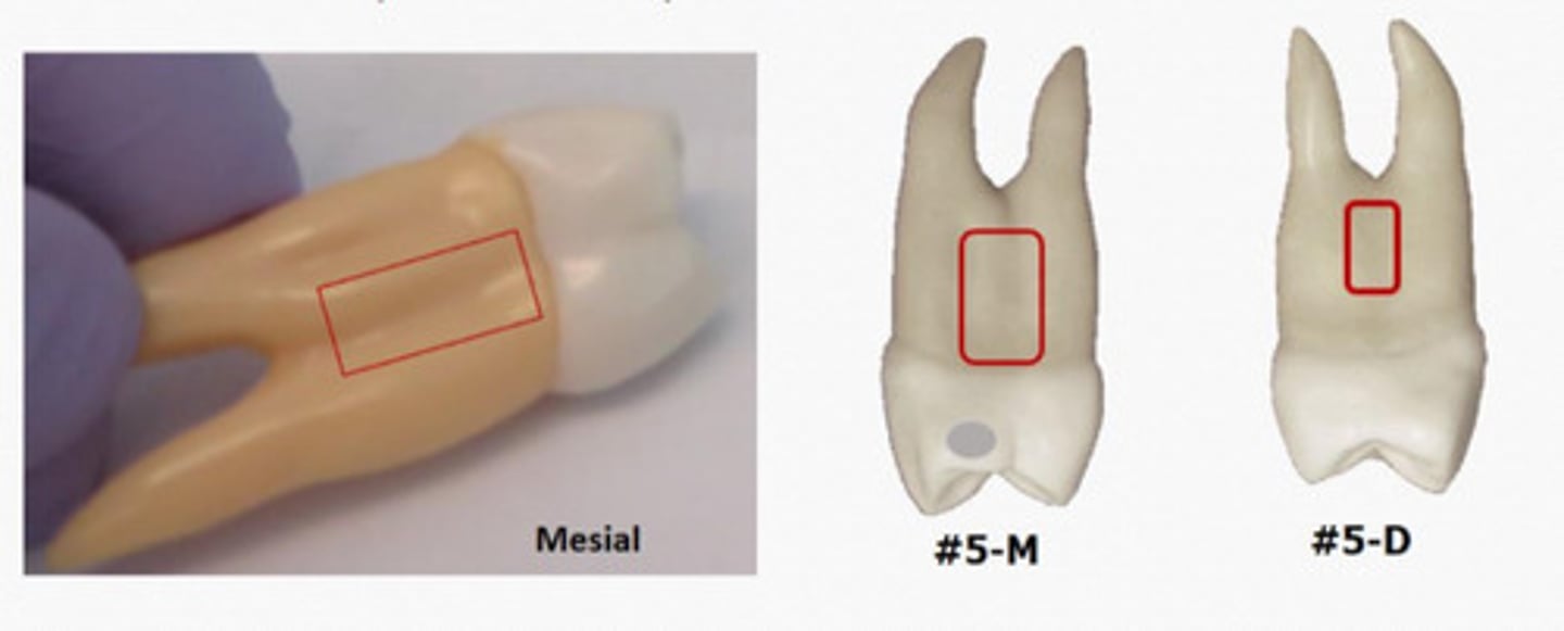 <p>Maxillary first premolar has a prominent __</p><p>both medially & distally.</p>