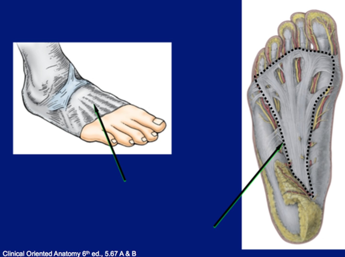 <p>Also called the plantar fascia.</p>