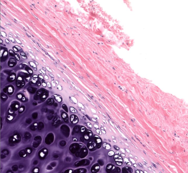 <p>(pink) type of connective tissue</p>
