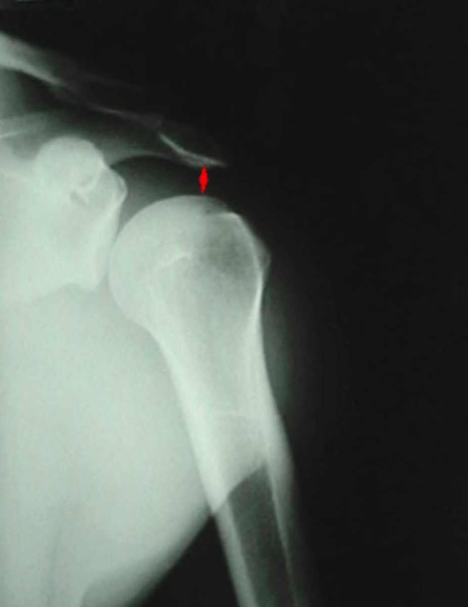 <p>What space is being indicated in this image?</p>