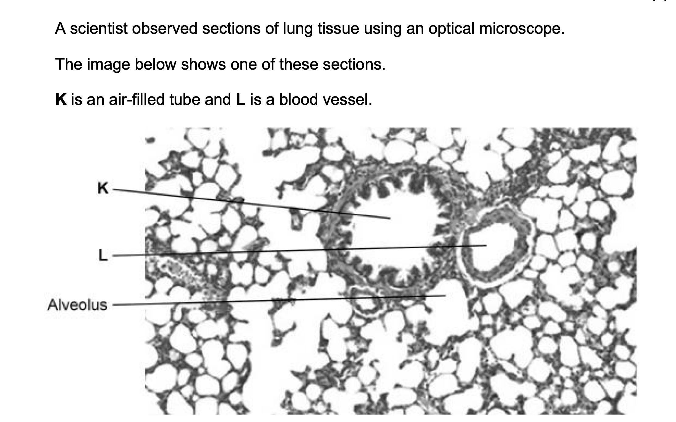 <p>Two solutions often used to stain tissues are haematoxylin solution and</p><p>iodine solution.</p><p>• Haematoxylin solution stains DNA a blue colour.</p><p>• Iodine solution stains starch a blue-black colour.</p><p>The scientist used haematoxylin solution and not iodine solution to stain</p><p>the lung tissue.</p><p>Suggest why.</p>