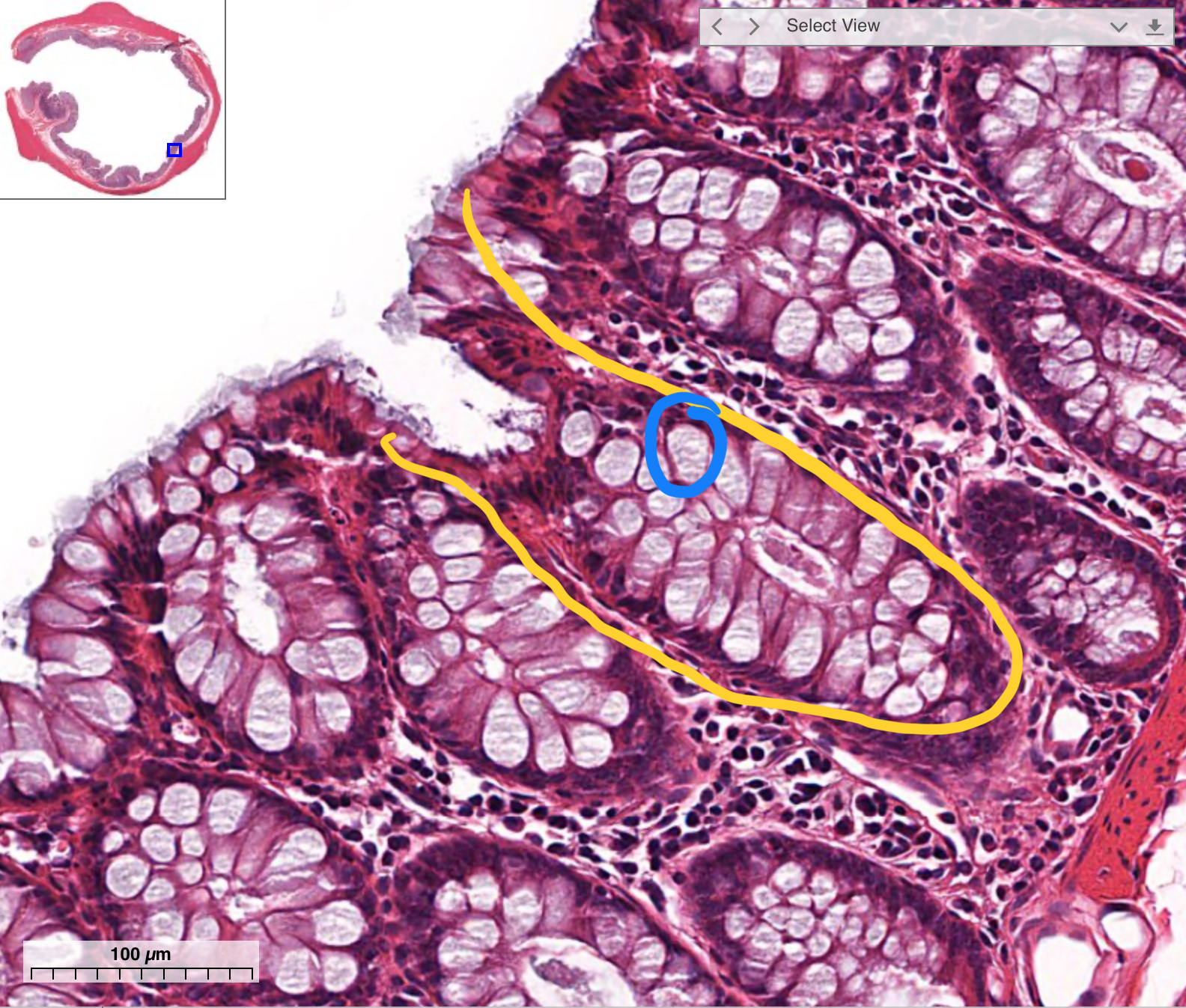 <p>What’s in yellow?</p>