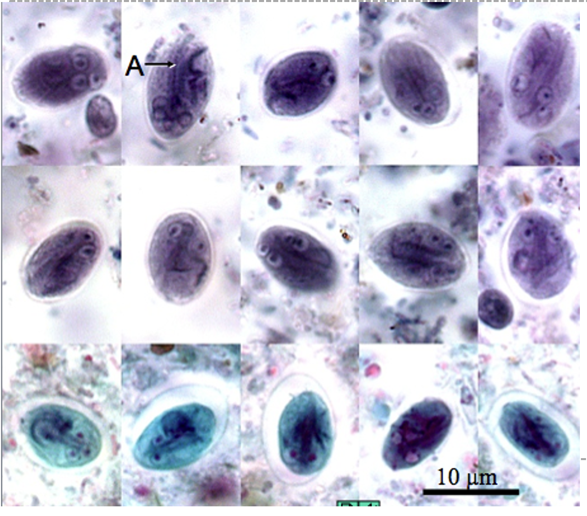 <p>Giardia duodenalis</p><p class="p1">Stage: Cyst</p><p class="p1">*Axonemes (internal flagellar structures)</p><p class="p1">*Nuclei (2–4)</p>