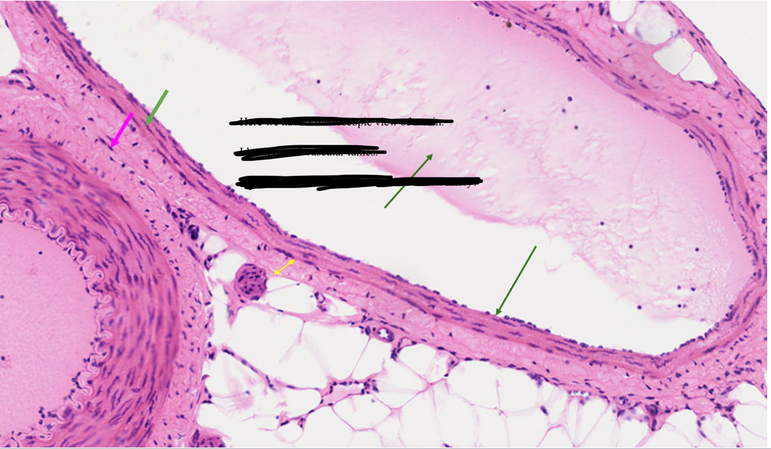 <p>Artery or vein?</p>