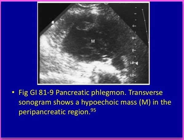 <p>Phlegmonous pancreatitis usually/commonly involves the ____ sac, ____ anterior _____ space, and transverse ______. </p>