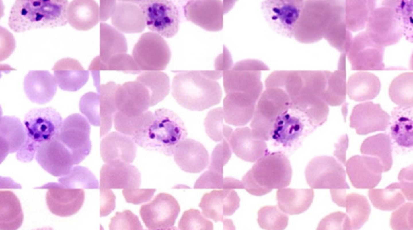 <p>(2) malarial parasite</p><p>ring form: DENSE ring with DENSE chromatin mass</p><p>trophozoite: COMPACT RING-shaped body inside RAGGED RBC</p><p>schizont: fill 3/4 of RBC; appear in IRREGULAR clusters</p><p>gametocyte: ROUND or OVAL</p>