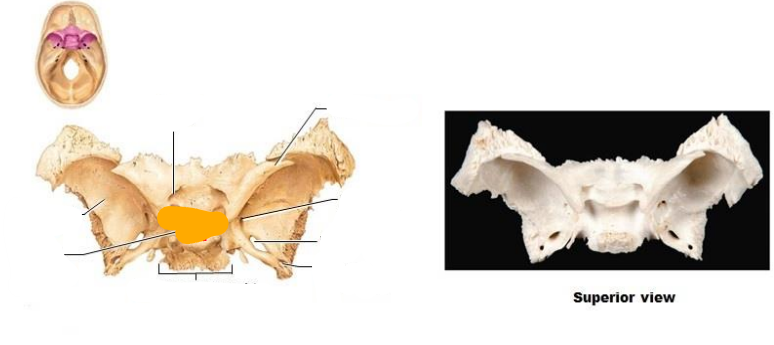<p>What is the sphenoid composed of? Superior view (9)?</p>