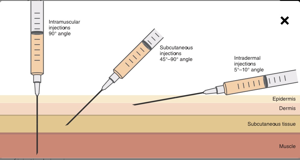 5-10 degree angle 