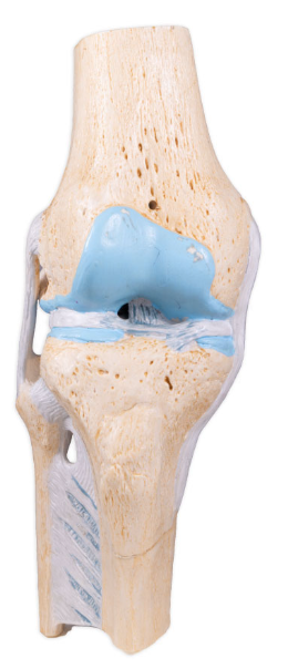 <p>What is the joint shown here?</p>