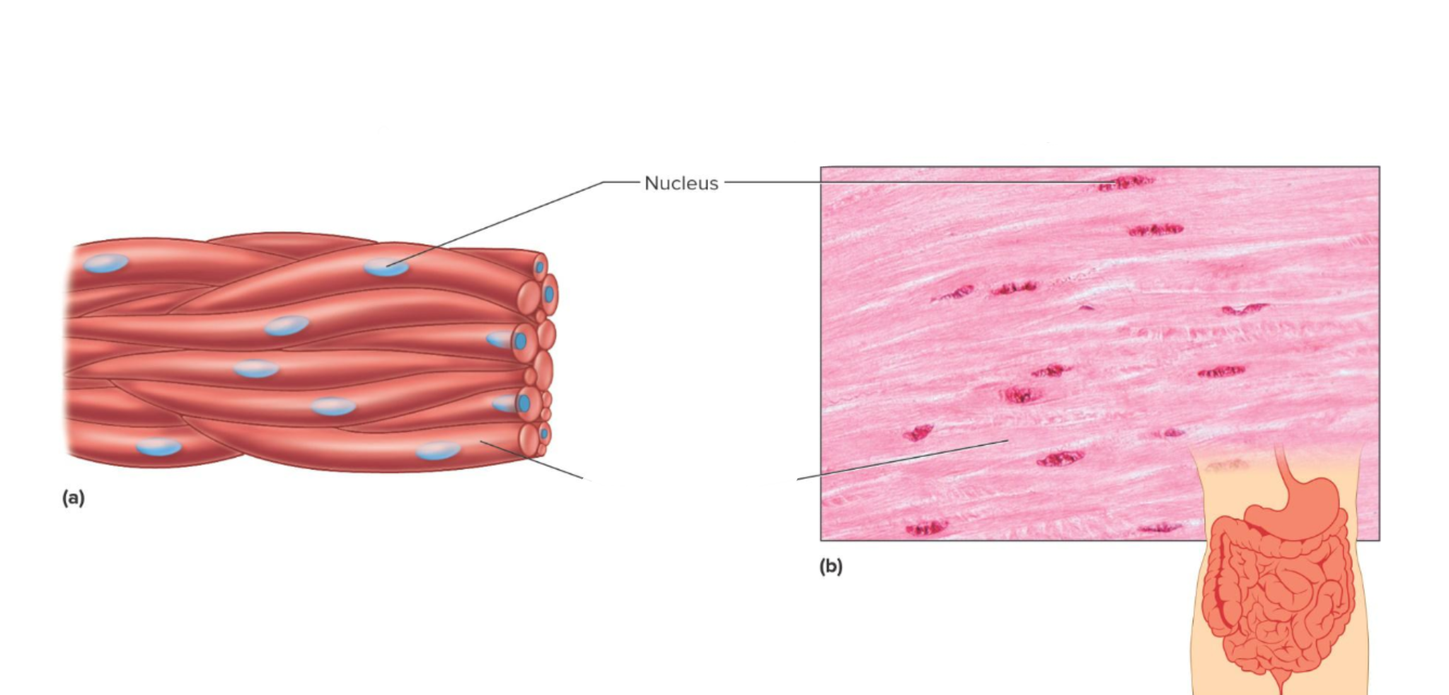 <p>Which muscle tissue is this </p>