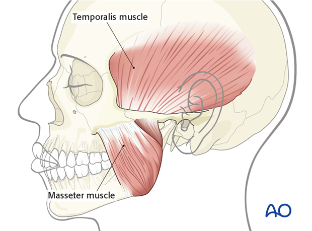 <p>Closes the mandible, located on the side of the jaw; responsible for chewing.</p>