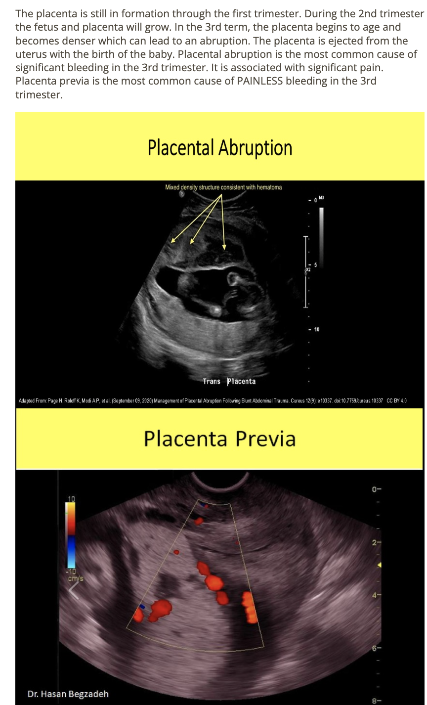 <p>a) placental abruption, placenta previa</p>