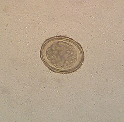 <p>Ascariasis</p><p>Helminth (nematoda, roundworm)</p><p>fecal-oral route</p><p>fecal smear</p>