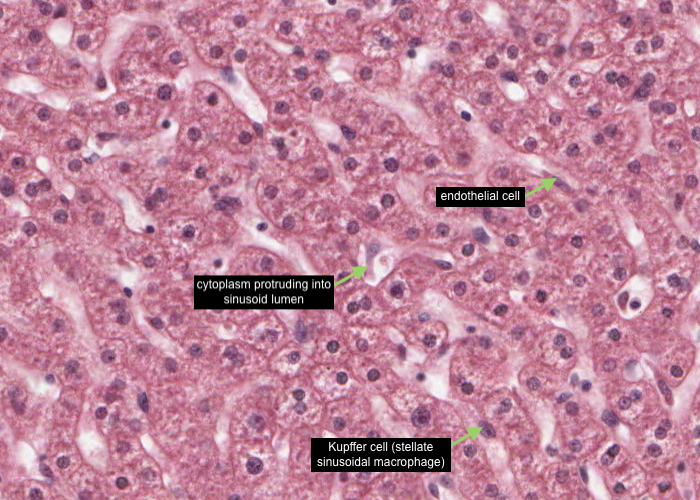 Kupffer cells - liver