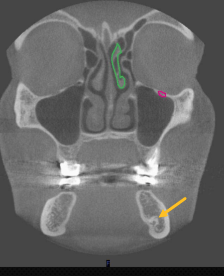 <p>what is the ARROW pointing to </p>