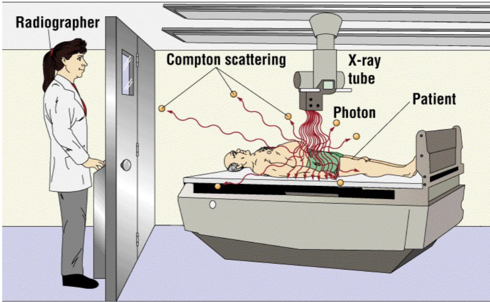<p><span style="color: rgb(255, 255, 255);"><span>majority of scatter radiation reaching image receptor (IR),&nbsp;contributes most to occupational exposure&nbsp;</span></span></p>