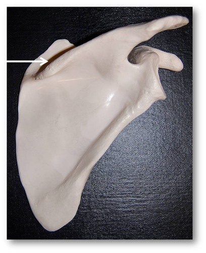 Name this specific area of the scapula.