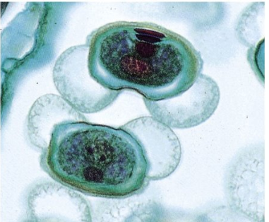 <p>What kind of pollen is this?</p>