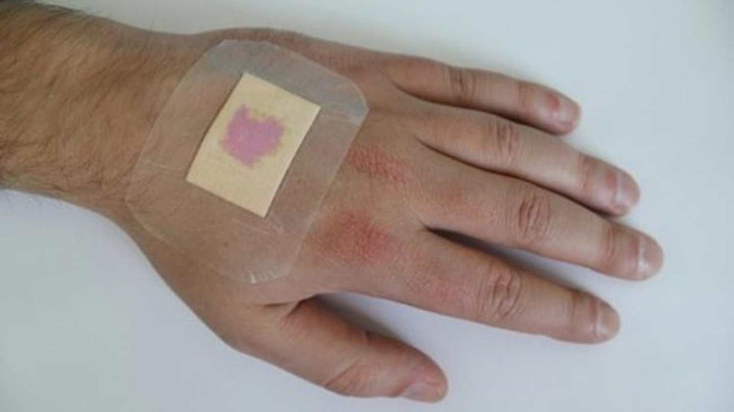 <p>a break or tear in the soft tissue of the body</p>