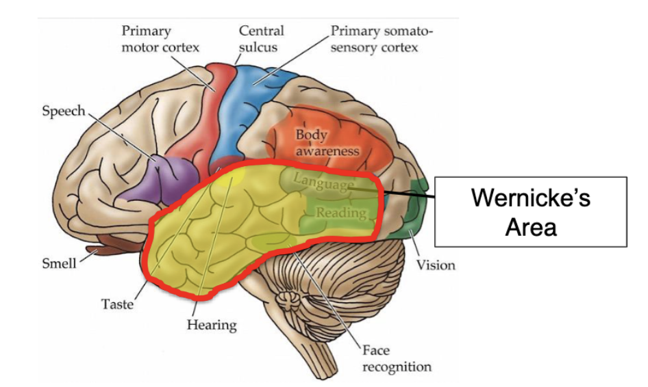<p>what is Wernicke’s aphasia?</p>