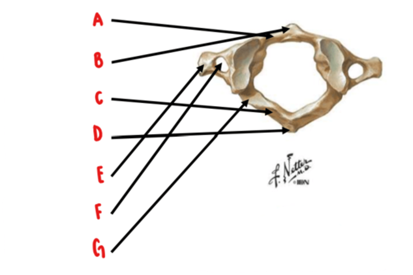 <p>Identify D</p>