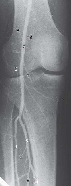 <p>1</p>