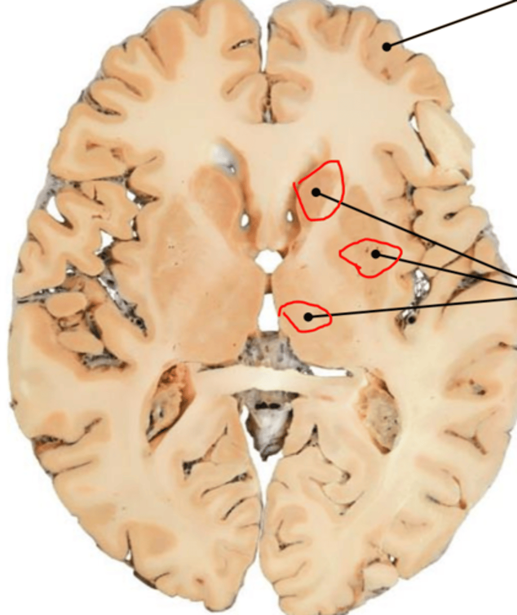 <p>collection of cell bodies, pass voluntary motor signals from cerebrum to other areas of brain and spinal cord</p>