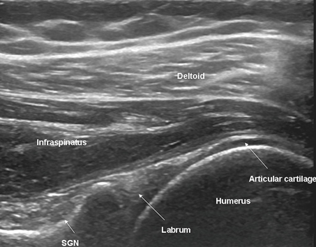 <ul><li><p>This includes evaluation of the shoulder, wrist, knee, and any other joints, tendons, and muscles of the extremities.</p></li><li><p>The search for foreign bodies may also be a requirement.</p></li></ul><p></p>