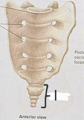 <p>What is structure #1?</p>