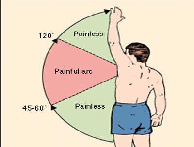 <p>Signs and Symptoms of SAIS - objective signs</p>