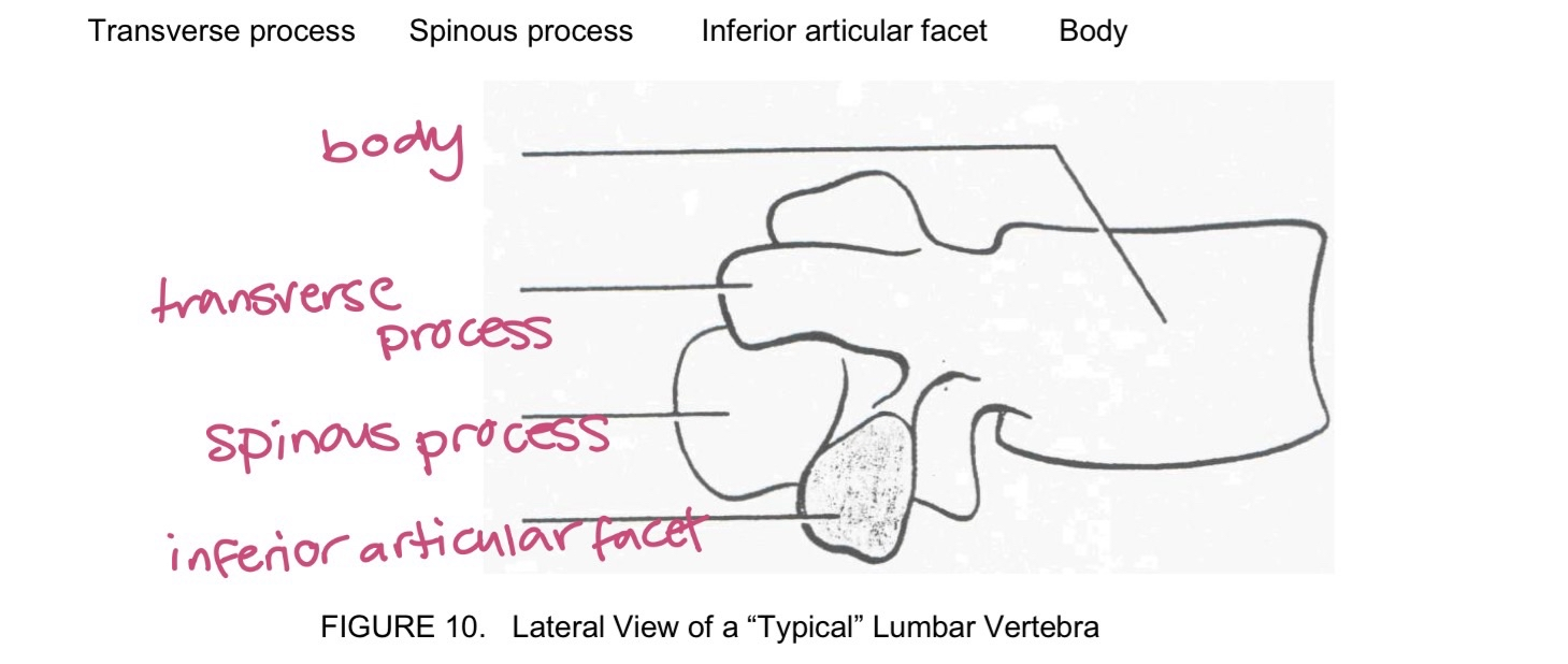 <p>L1-L5 lumbar vertebrae</p>