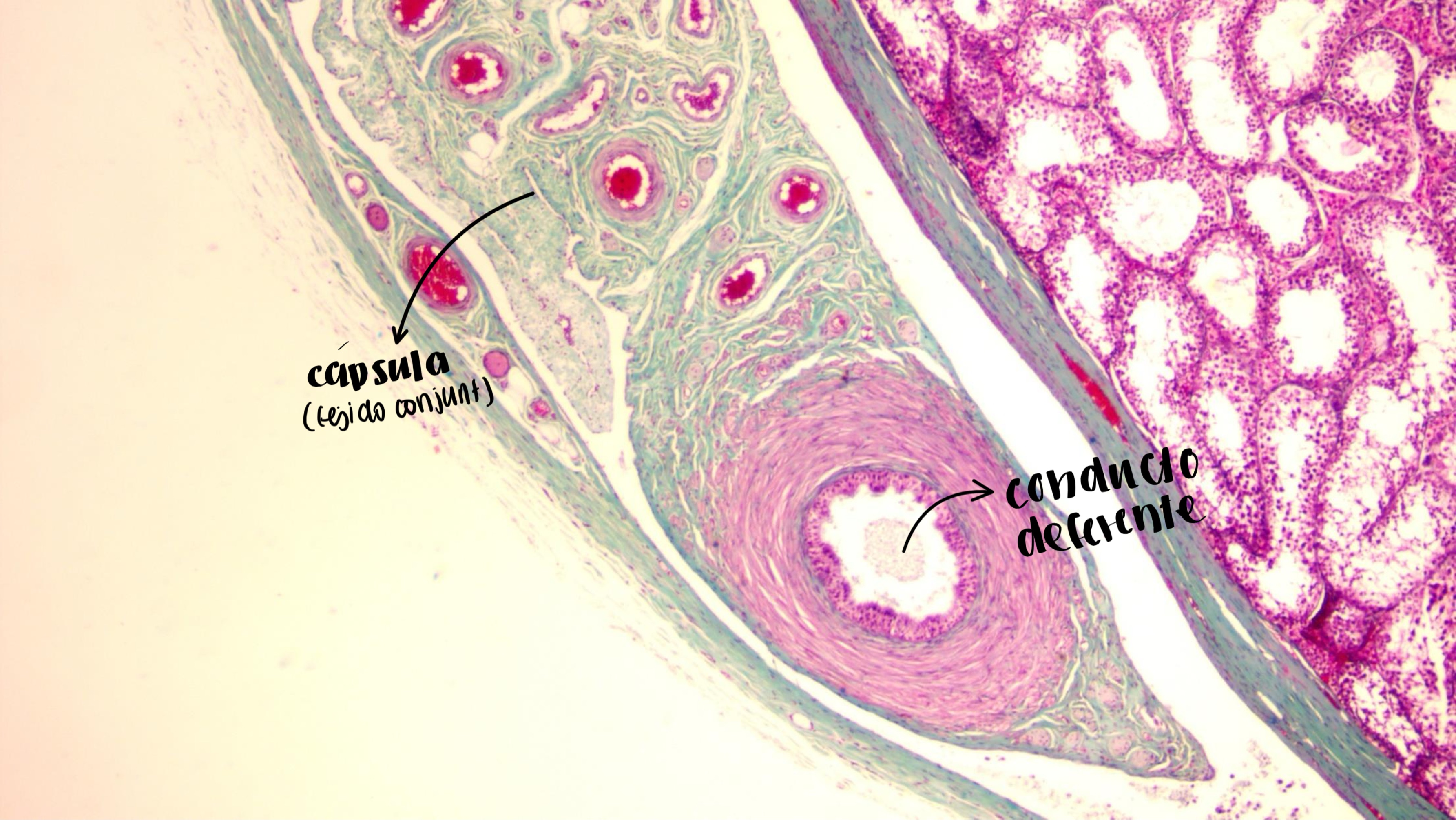 <p>conducto deferente</p>