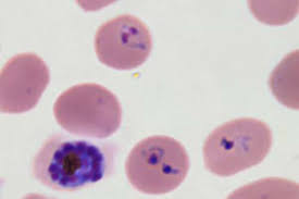 <p>Identify the type of red cell.</p>