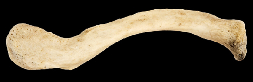 <p>Name this bone.</p><p>Left side or right side?</p><p>(Superior view).</p>